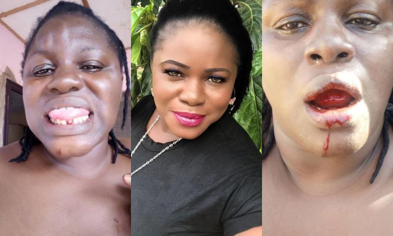Ex-wife of Ayalolo Transport PRO makes damning allegations of serious physical abuse