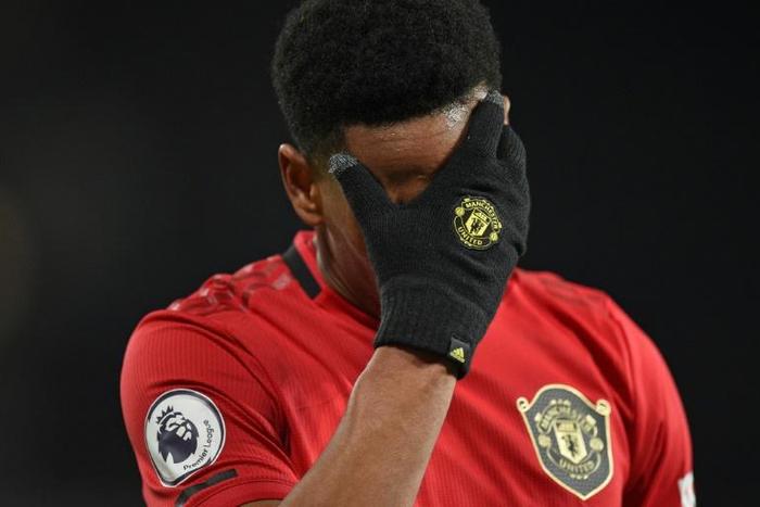 Anthony Martial holds his head as Manchester United drew 2-2 with Aston Villa