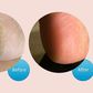 This Callus Remover Will Give You Baby-Soft Feet