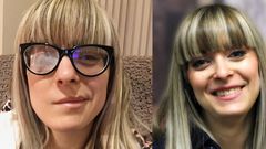 'Ramsay Hunt Syndrome Paralyzed Half My Face'