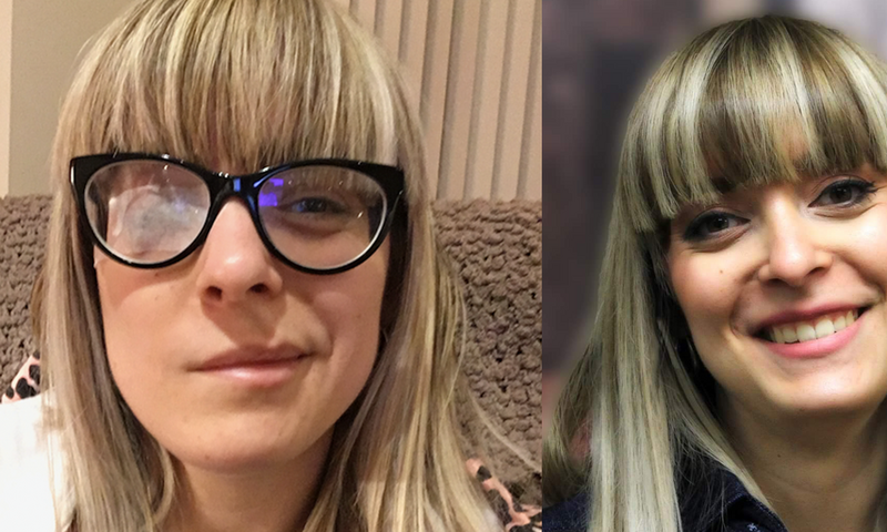 'Ramsay Hunt Syndrome Paralyzed Half My Face'