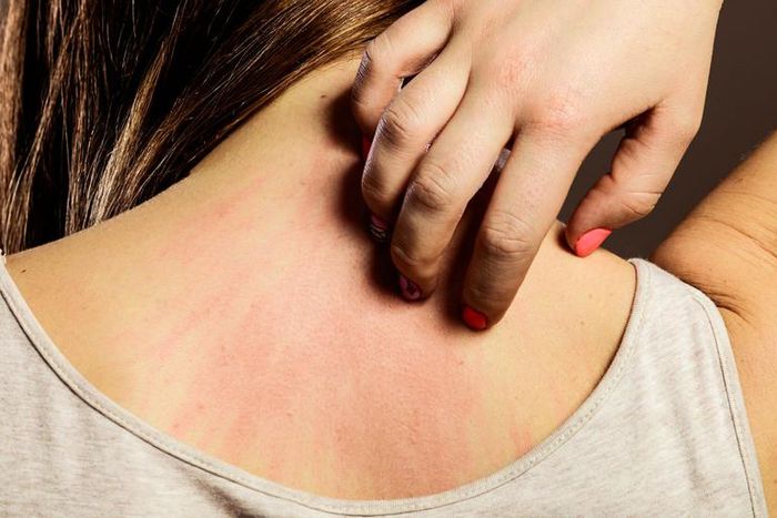 23 Causes Of Skin Redness (With Photos!)