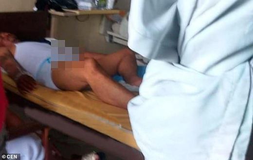 Man in hospital after a 3-day erection from Viagra meant for cattle and the lady didn't show up
