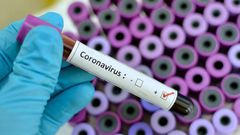 Ghana confirms two cases of coronavirus, Ministry of Health says