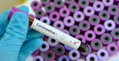 COVID-19 test kit