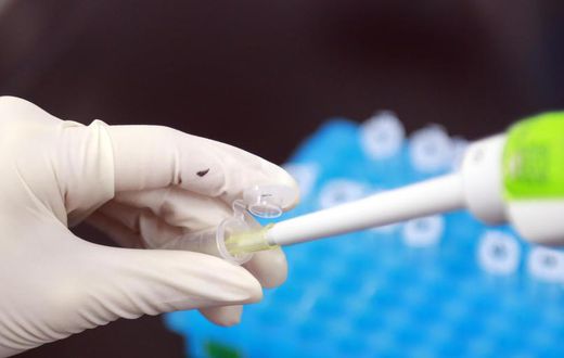 Will Antibody Tests Help End COVID-19?