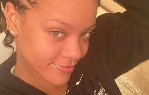 Rihanna Just Posted A No-Makeup Selfie With Pimple