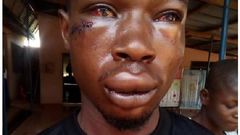Hayford Osei victim of assault