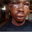 Hayford Osei victim of assault
