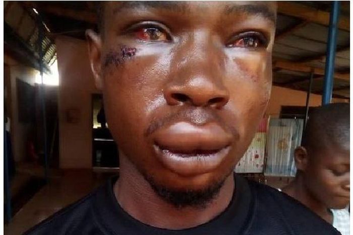 Hayford Osei victim of assault