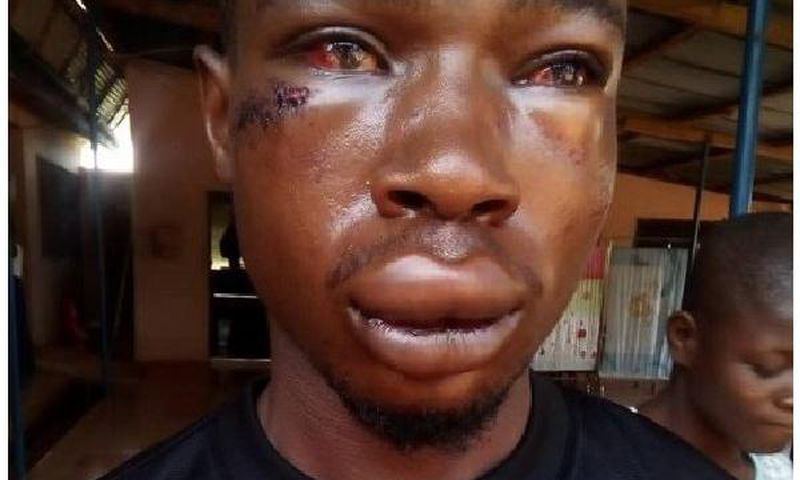 Hayford Osei victim of assault