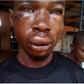 Hayford Osei victim of assault