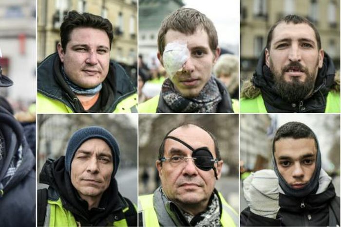 Scores of yellow vest protesters were maimed by rubber bullets or stun grenades, some losing an eye or a hand