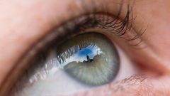 Dr. Pimple Popper Pops a Blackhead Next to an Eye