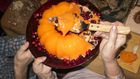 Dr. Pimple Popper Removes a 'Jell-O' Lipoma