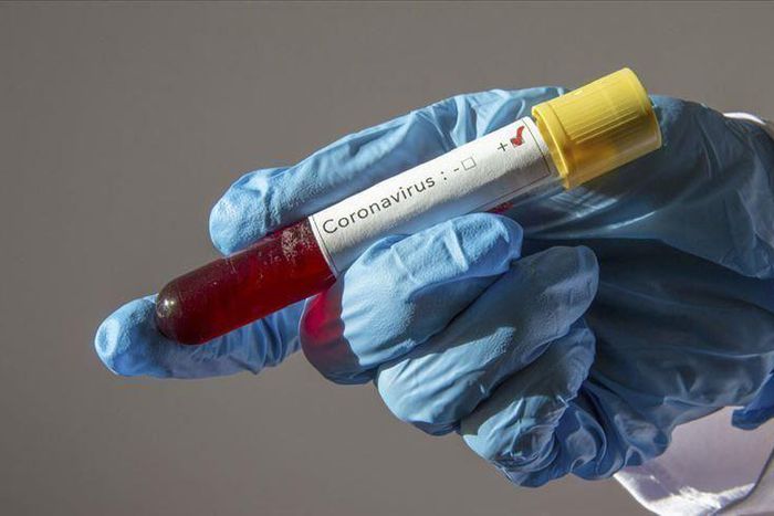 Covid19 : 121 nouveaux cas dont 2 communautaires, 48 guéris, 6 cas graves, 1394 personnes sous traitement