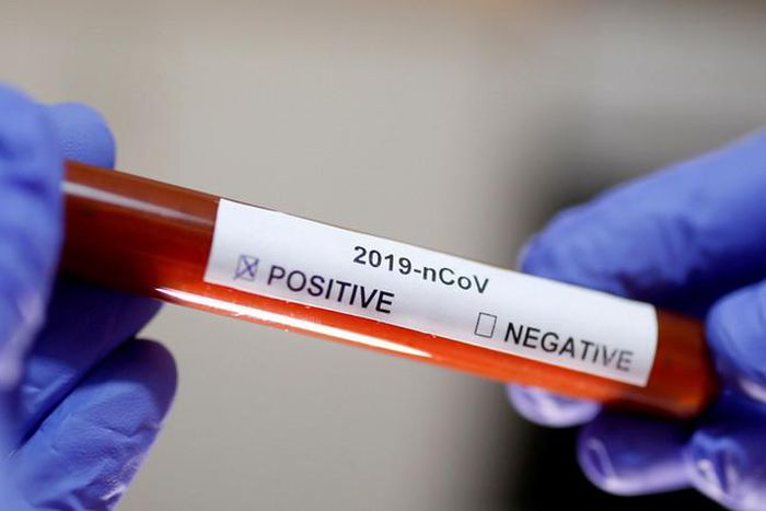 Covid-19 : 94 nouveaux cas dont 10 communautaires, 57 guéris, 14 cas graves, 1838 personnes sous traitement