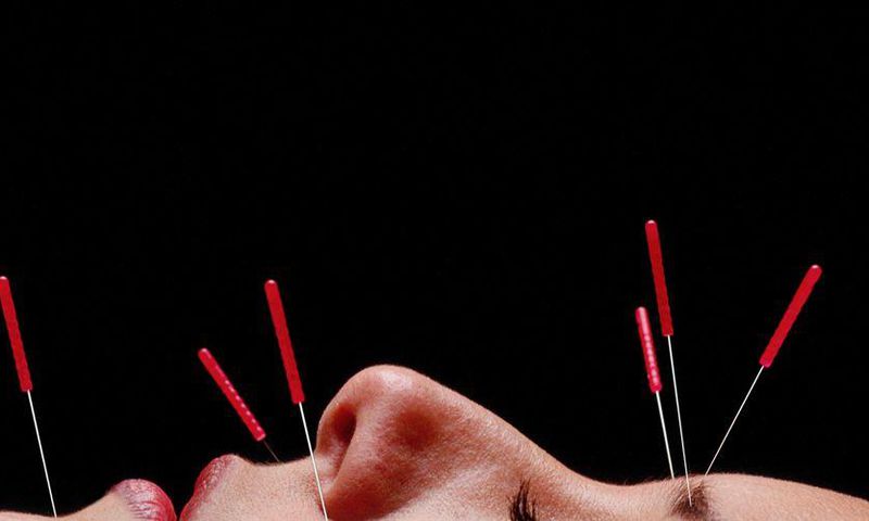 Can Acupuncture Really Help You Lose Weight?