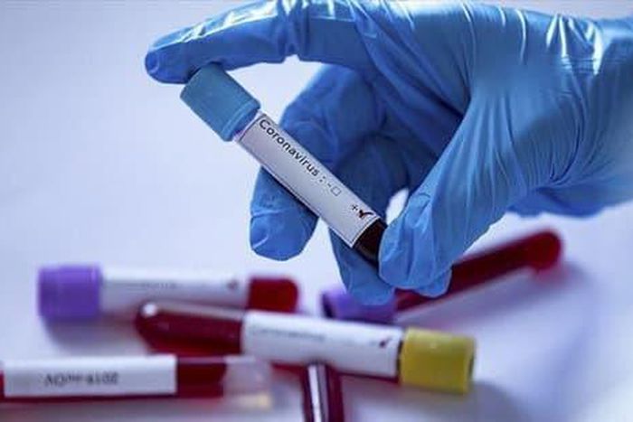 COVID-19: CINQ NOUVEAUX DÉCÈS ET UN CAS GRAVE DE PLUS