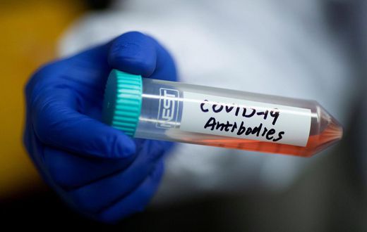 A tube with a solution containing COVID-19 antibodies.