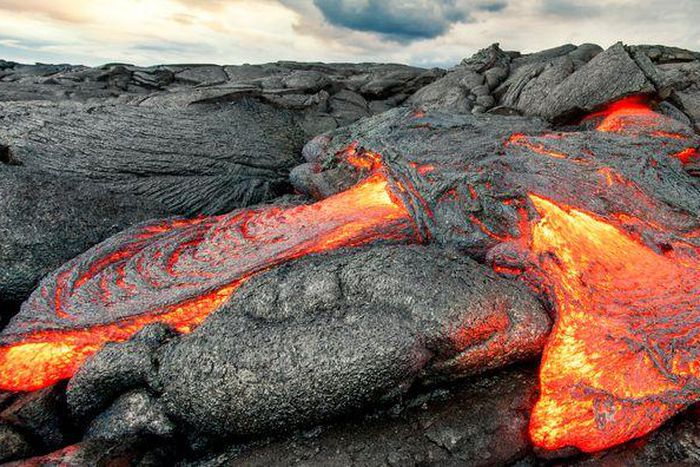 Watch Dr. P Squeeze 'Molten Lava' From Pilar Cyst