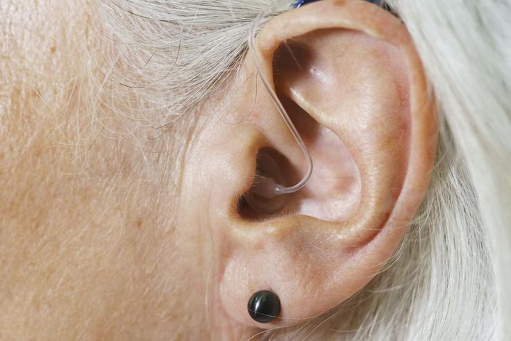 Watch Dr. P Extract An 'Earring' Blackhead