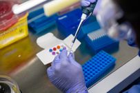 Coronavirus (COVID-19) test in a Nigerian lab [NCDC]