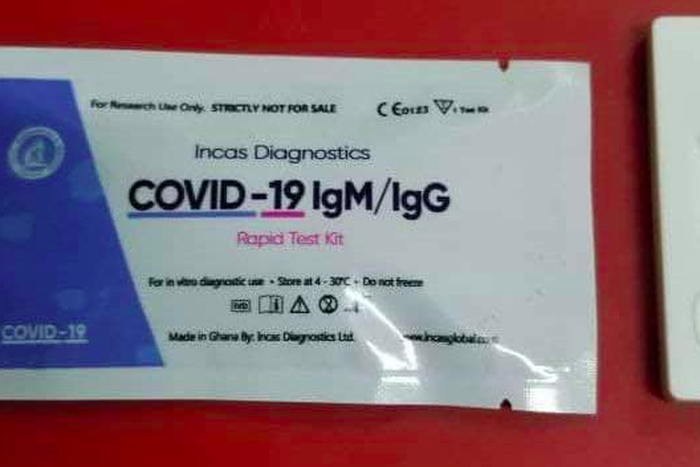 The test takes 15 to 20 minutes to perform