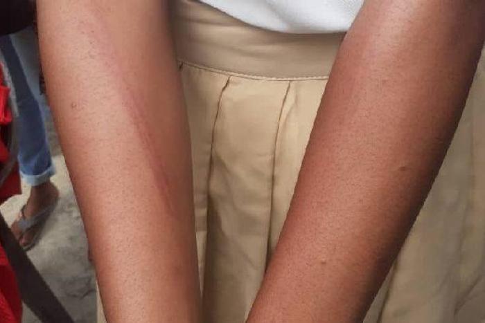 19-year-old assaulted by soldiers