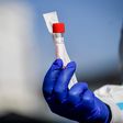 coronavirus test