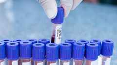 What to Know About COVID-19 Pool Testing