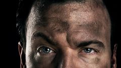 Dr. Pimple Popper Pops Soot-Filled Blackheads