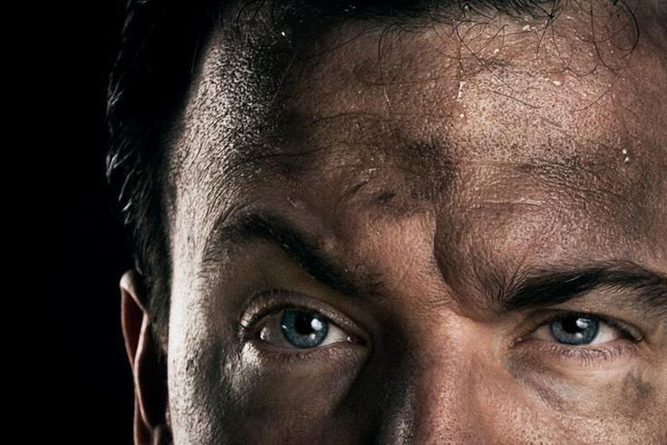 Dr. Pimple Popper Pops Soot-Filled Blackheads