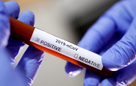 Hydrogen Peroxide not an approved treatment for COVID-19 – GMA
