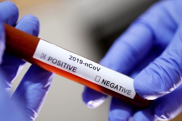 Ghana’s COVID-19 case count surpasses 9,000, death toll rises to 42