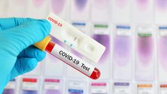 Covid-19 : 145 nouveaux cas dont 26 communautaires, 62 guéris, 47 cas graves, 1 décès...