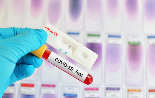 Covid-19 : 145 nouveaux cas dont 26 communautaires, 62 guéris, 47 cas graves, 1 décès...