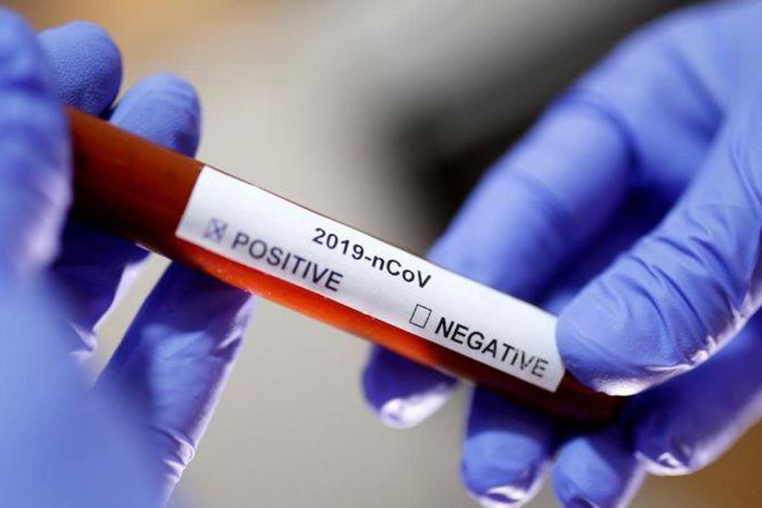 Ghana’s COVID-19 cases move up to 5,918