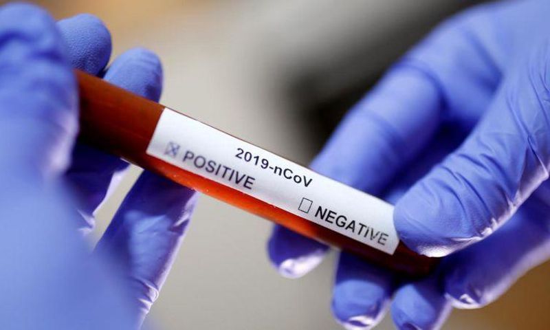 Ghana’s COVID-19 cases move up to 5,918