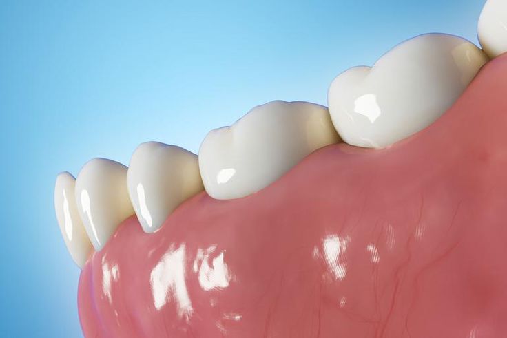 Dr. Pimple Popper Pops a 'Big Tooth' Cyst