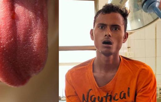 ‘Concerned’ man cuts off his tongue for sacrifice to stop the spread of COVID-19
