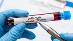 COVID-19 cases in Ghana move up to 3,091