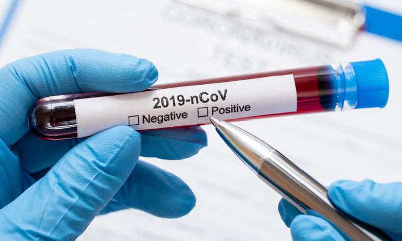 COVID-19 cases in Ghana move up to 3,091