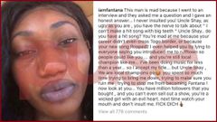 Fantana drags Wendy for insulting her with her teeth
