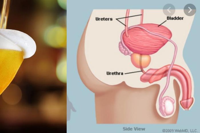 Man's bladder bursts after drinking 10 beers but refusing to urinate for 18 hours