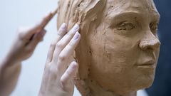 Watch Dr. P Masterfully Repair An Earlobe