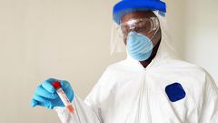 Covid-19 : 82 cas positifs dont 4 importés, 13 cas communautaires, 34 guéris, 1930 personnes sous traitement