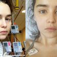 Emilia Clarke Shares New Pics After Brain Surgery