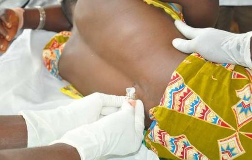 Upper West Region: CSM cases move up to 315 with 45 deaths