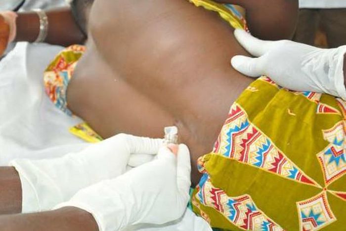 Upper West Region: CSM cases move up to 315 with 45 deaths
